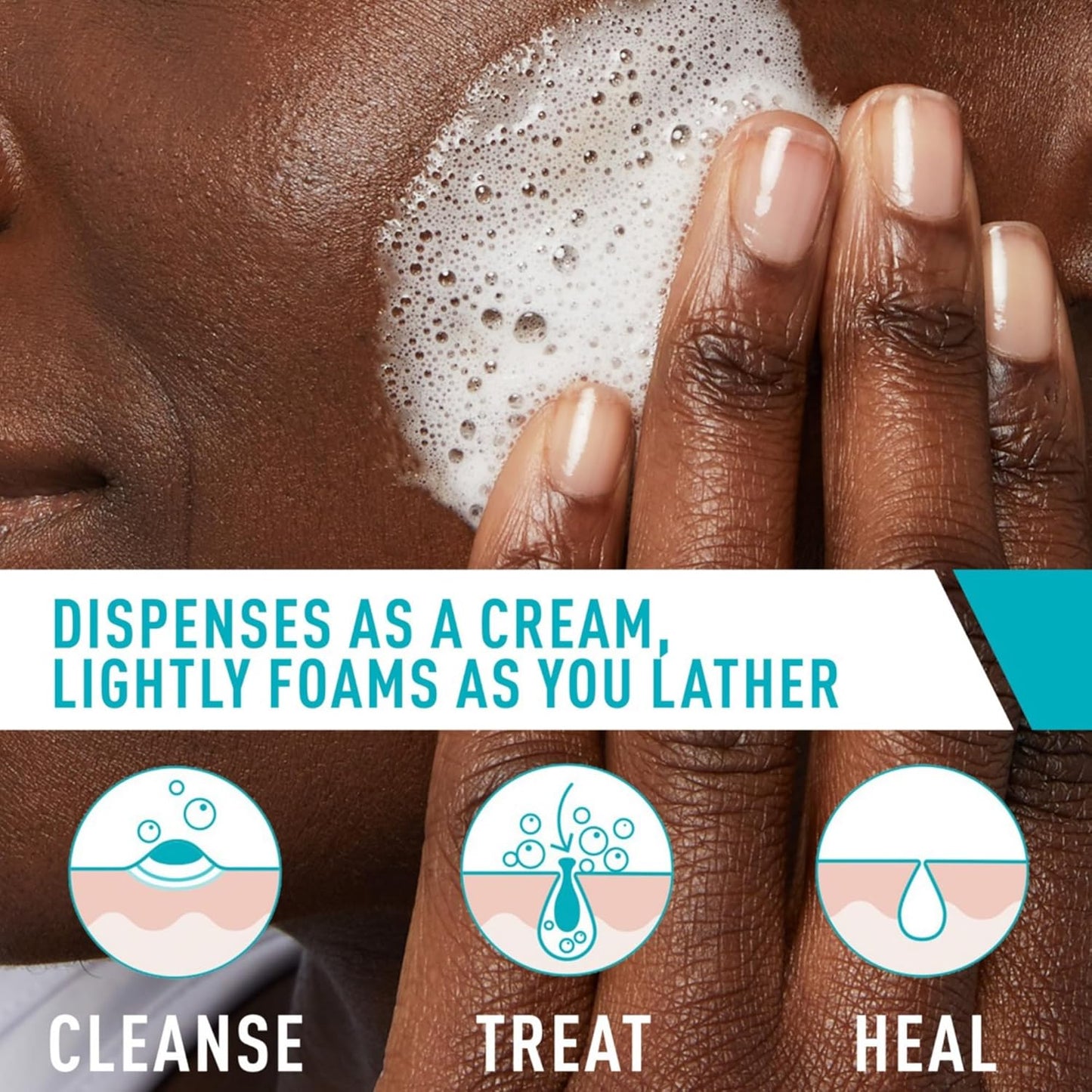 CeraVe acne foaming face wash transforming from cream to foam, demonstrating cleanse, treat, and heal benefits.